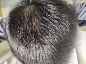 블랙포레 탄산쿨링 사용 4주