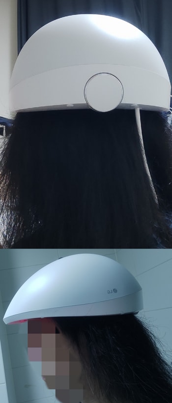 정수리가 옆,뒷머리 반이라도 됐으면!