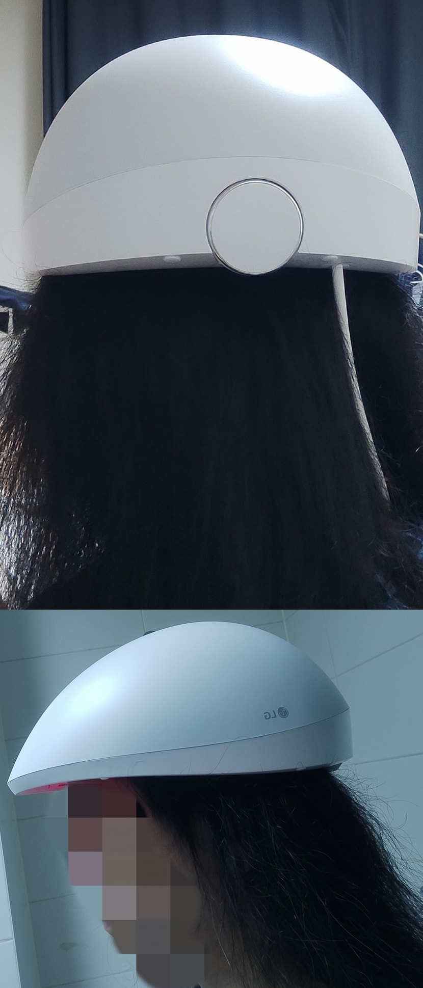 정수리가 옆,뒷머리 반이라도 됐으면!