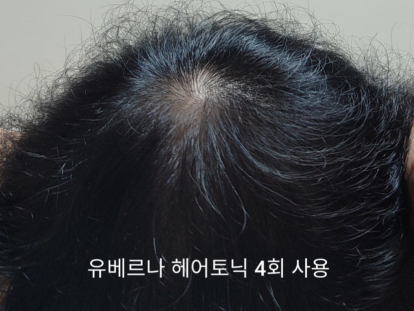 정수리 집중 케어!