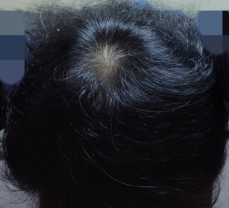 모제림 X 세라젬 다섯번째 후기