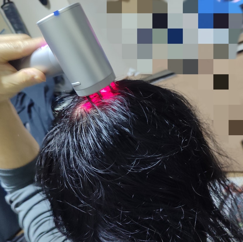 오로지 정수리부분 엠플 집중샷