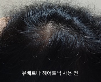 유베르나 헤어토닉 사용 전