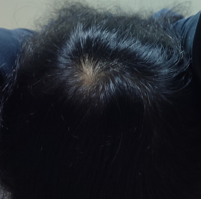 모제림 X 세라젬 사용 3주차