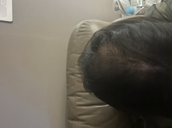 평일에는 머리를 만지고가서 오전오후 사용못하고 저녁에와서 세번 사용하고있어요 와근데 벌써 좋다는 느낌이있어요 전 무향 입니다 한방향 궁금하네요 ㅎㅎ 