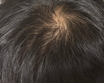 3주차 머리상태