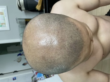 약복용23일후