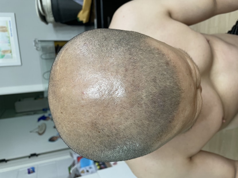 약복용23일후