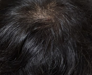 1주차 머리 상태