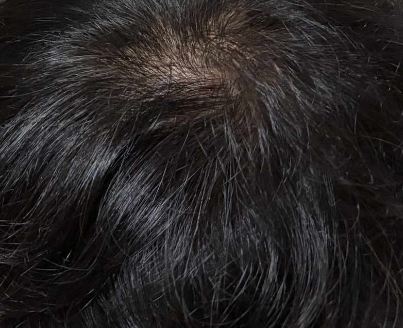 1주차 머리 상태