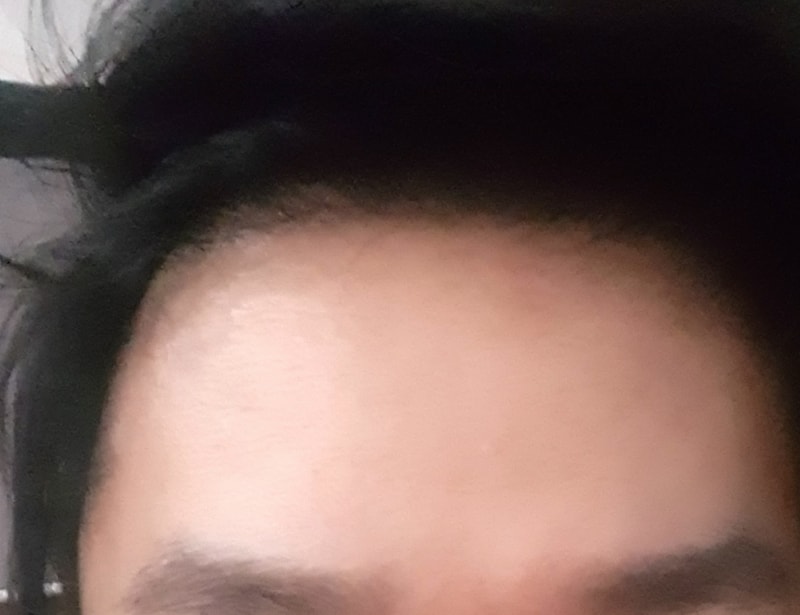 チェウムルチン ブラックフォーメン ビオチン オクタコサノール 4週目 体験談