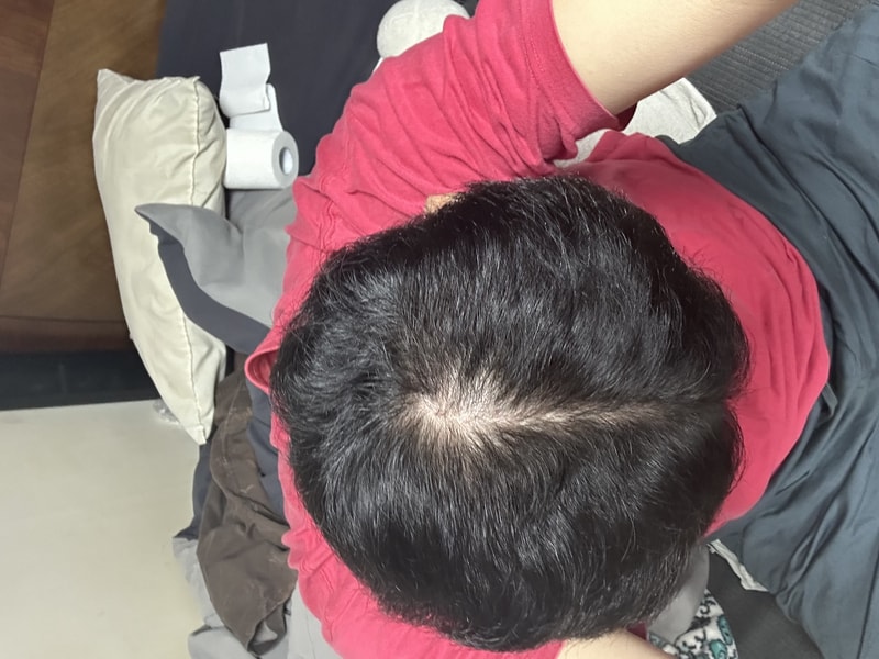 [4주차]하움 샴푸 4주차 후기