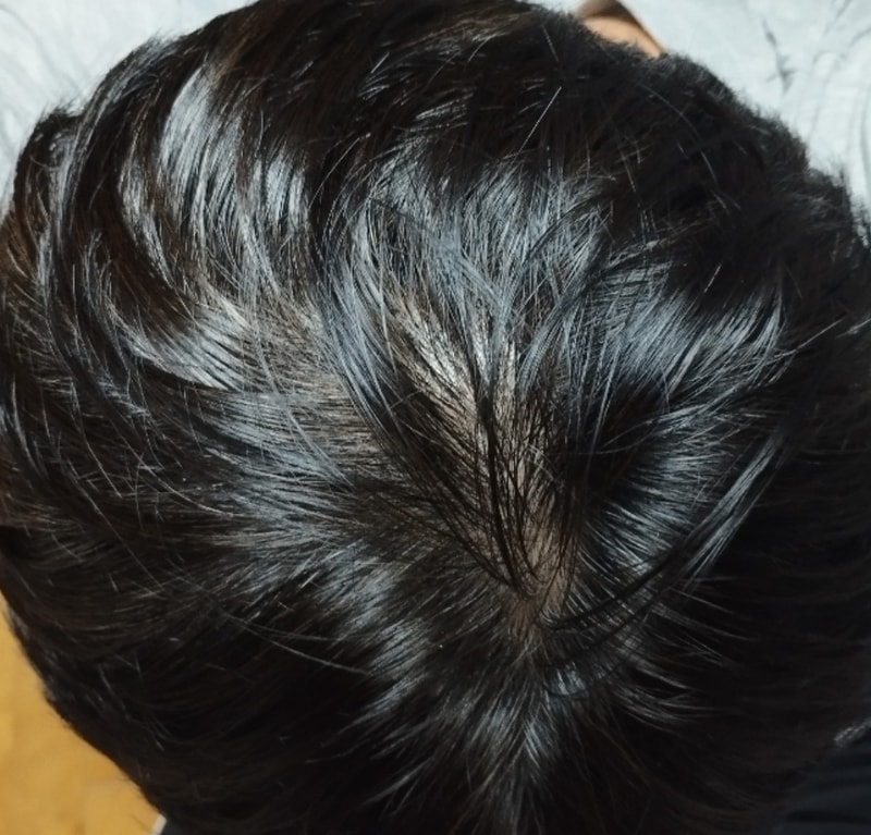 뮤리나 1차 후기