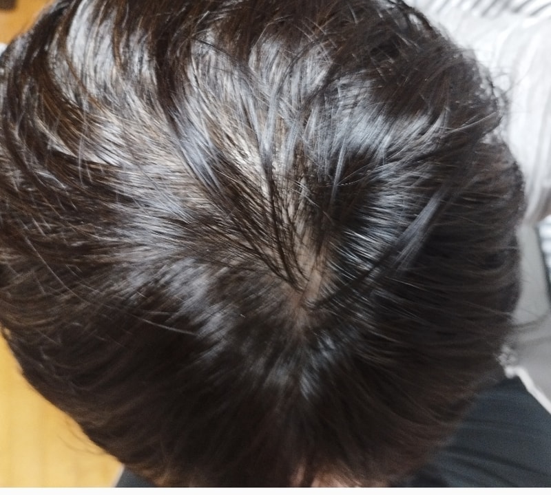 닥터포헤어 4주차