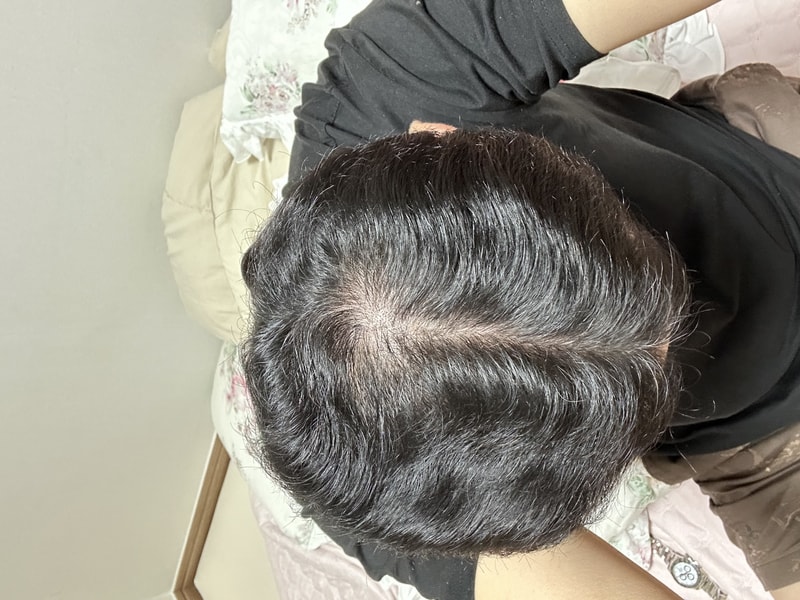 [2주차] 뉴프리미엄 TS 샴푸 사용기