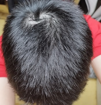 머리 사진 사용전