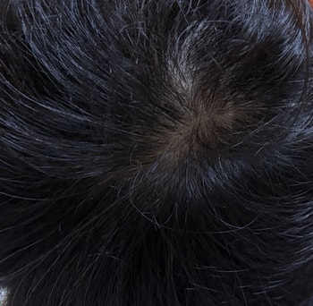 4주차 머리 상태