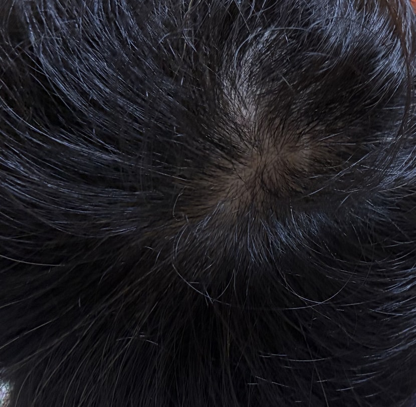 4주차 머리 상태