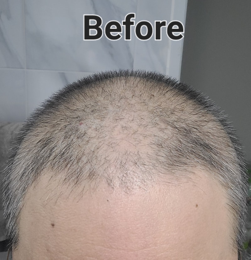 ビエルモパッケージ第1週目の体験談