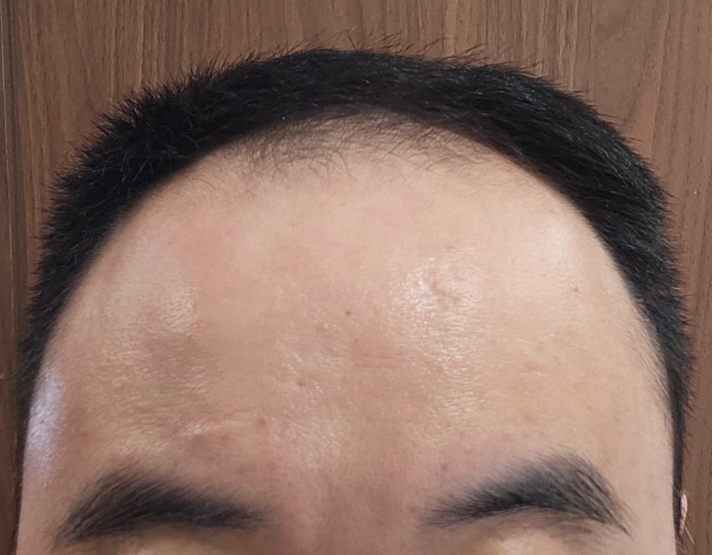 블랙포레프로즌 1주차 후기