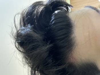 사용 전 m자 부근에 빨갛게 부어 있었습니다.