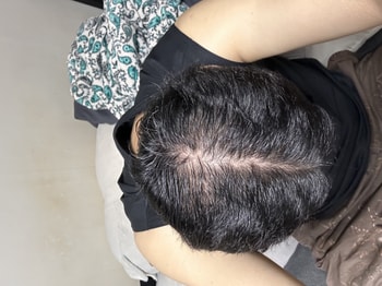 샴푸훈 진정된 두피 느낌