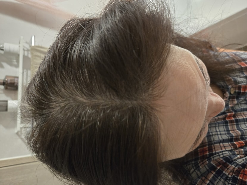 사용중 두피상태