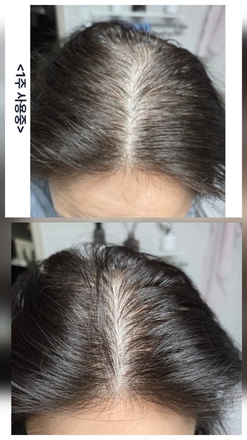 4주 사용전과후