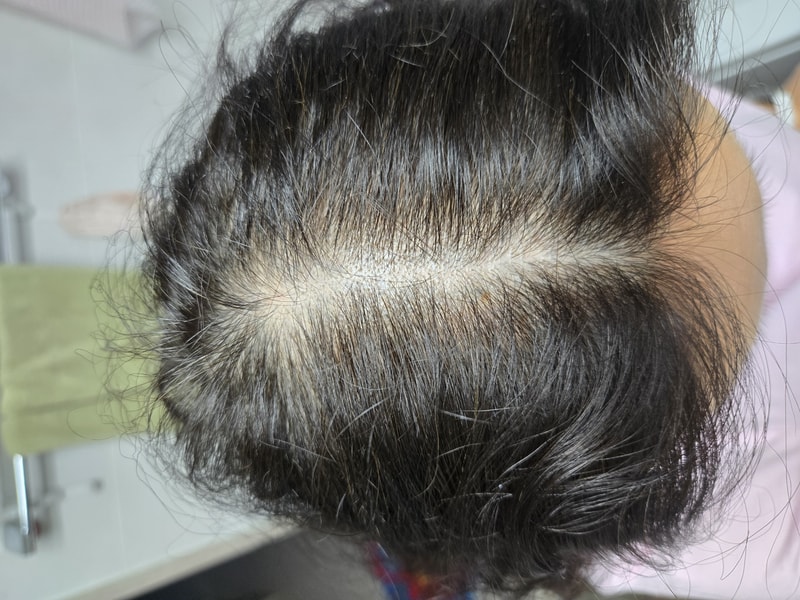 ブラックフォーレルートパワーシャンプー2週目の体験談