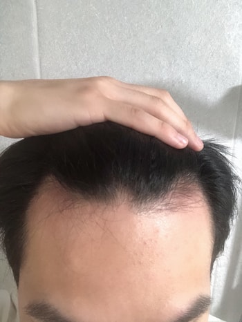샴푸를 드라마틱한 효과는 없으나, 진정이나 쿨링감에서 기대를 좀 해봐야겠네요.