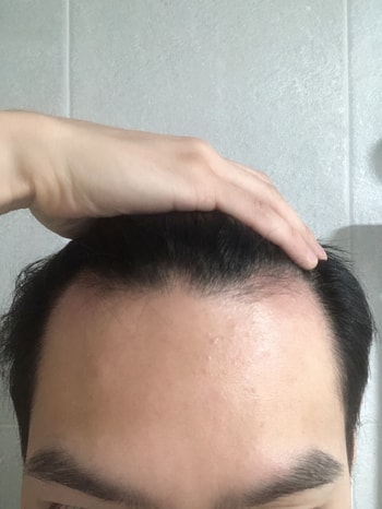 좀 더 나아지는 기미라도 보이길 희망합니다ㅠㅠ