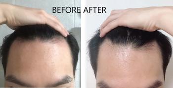 Before - 첫 사용 이후, /  After - 4주차 마지막날