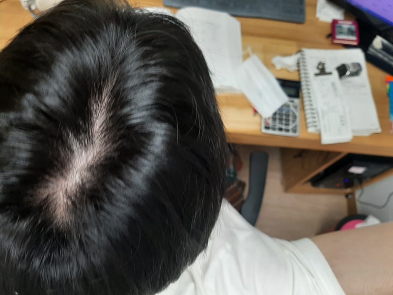 [4週目]メディキューブ体験談