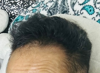 앞머리 잔털이 최근 많이 올라옵니다