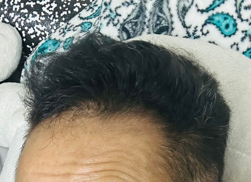 앞머리 잔털이 최근 많이 올라옵니다