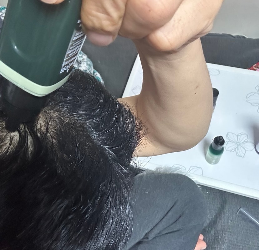 이틀에 한 번씩 미녹시딜 도포 후 눌러줍니다