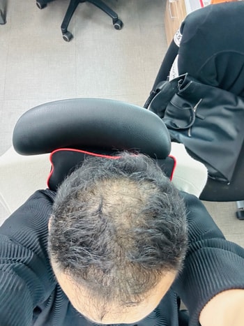 관리 전.... 절대 다시 돌아갈 수 없는 시절입니다.