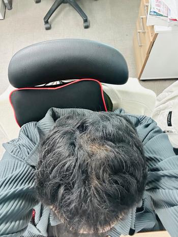 더마시모 사용 직전