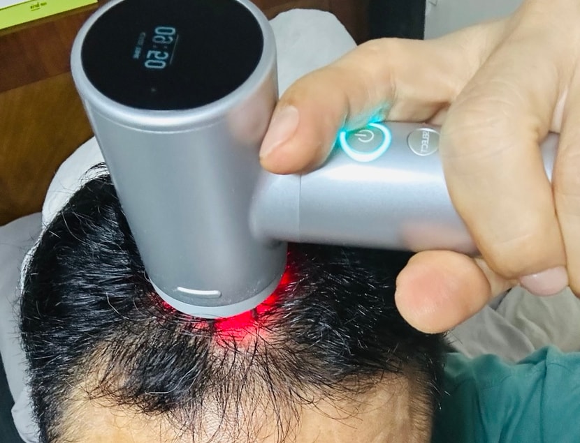 잘 흡수 되라고 이런 기기로 30분 정도 두피케어를 해줍니다.