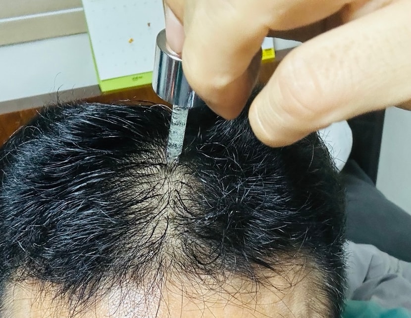 동봉된 스포이드로 잘 발라주구요.