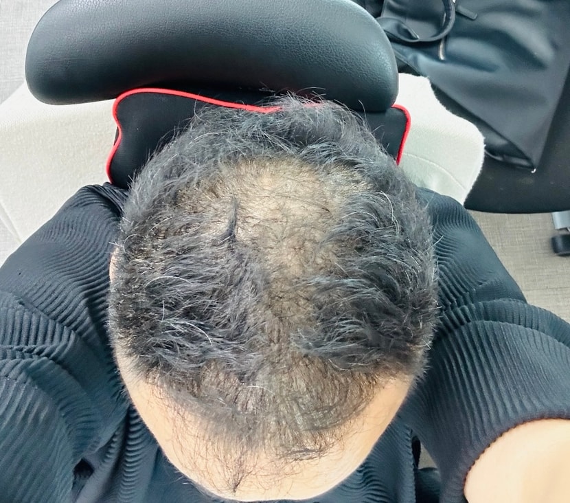 관리 전 사진입니다.