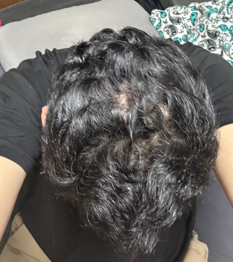 Dr.For Hair头皮精华液