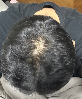 관리 전과 비교하면 상전벽해 입니다.