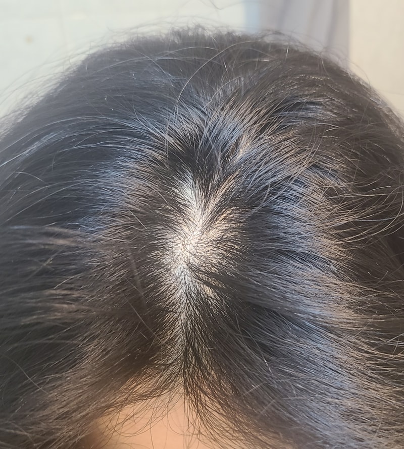 3週目の体験談です。