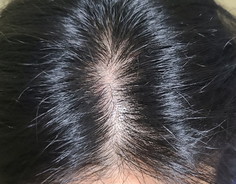 2週目の体験談です