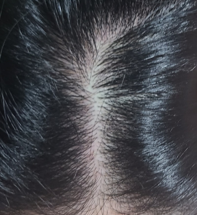 3週目の体験談です。