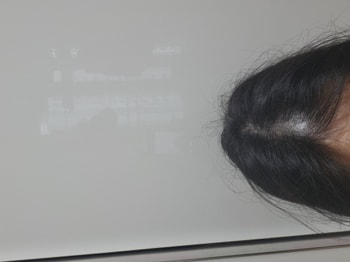 사용후사진입니다