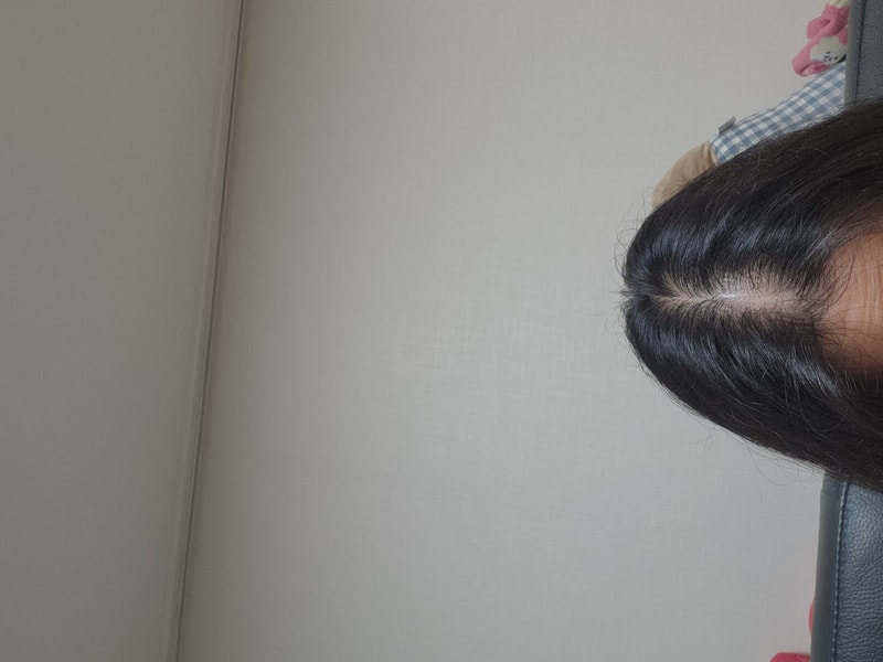 ヘアミラクル7週目の体験談です