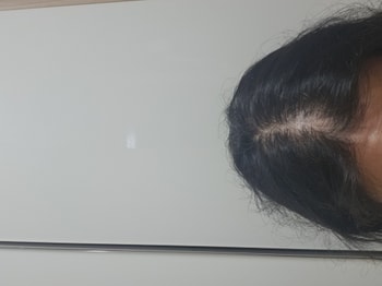 사용전사진입니다
