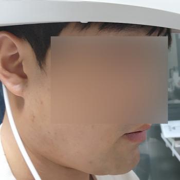 메디헤어 제품 사용 하는 사진